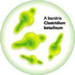 Botulismo Alimentar Botulismo Causado por Intoxicação Alimentar