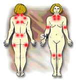 Fibromialgia e suas complicações