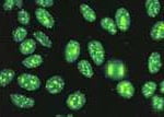 Aparelho de Golgi Aparelho de Golgi