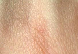 O maior Órgão do Corpo O maior Órgão do Corpo